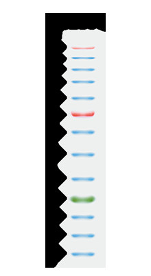11 Bant 9-180KDA Mavi Yüksek Menzilli Protein Markörü 2x250ul 3 Renk 25-300kDa